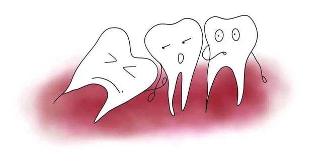 牙齿磕碰后不松动就没事？有种牙外伤叫牙震荡